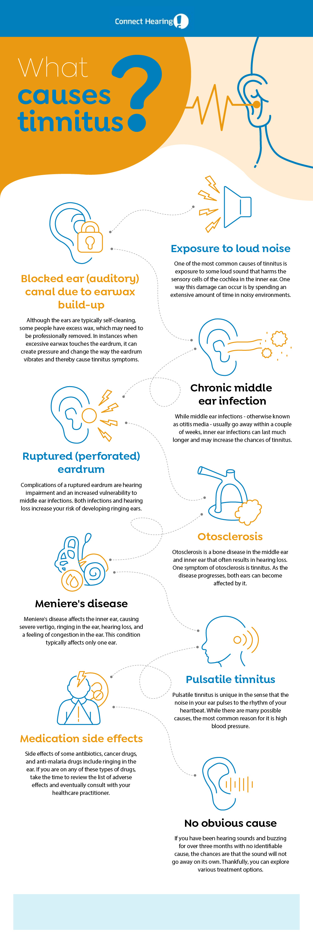 Met opzet holte rekken Everything you need to know about tinnitus and how to make it go away |  Connect Hearing