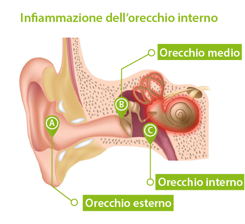 infografica anatomia di un orecchio con orecchio esterno orecchio medio orecchio interno con infiammazione
