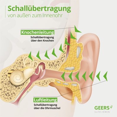 La conduction osseuse de l’oreille